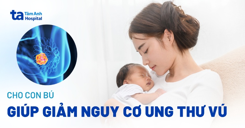 Cho con bú giúp giảm nguy cơ ung thư vú không? Lưu ý tư thế đúng