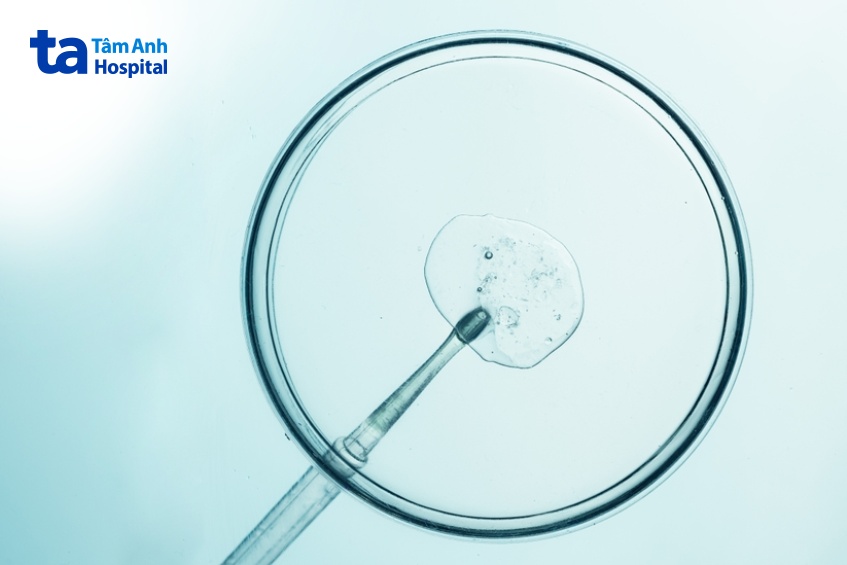 đặc điểm của tinh dịch