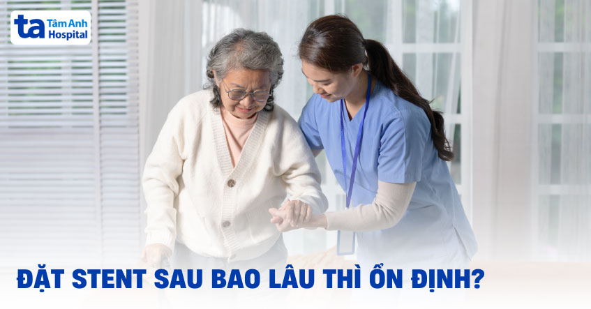 Đặt stent sau bao lâu thì ổn định và được xuất viện? [GIẢI ĐÁP]