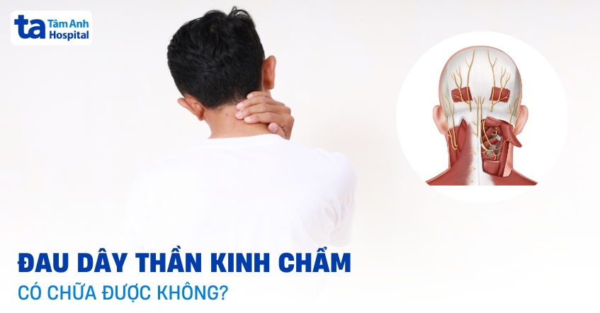 đau dây thần kinh chẩm có chữa được không