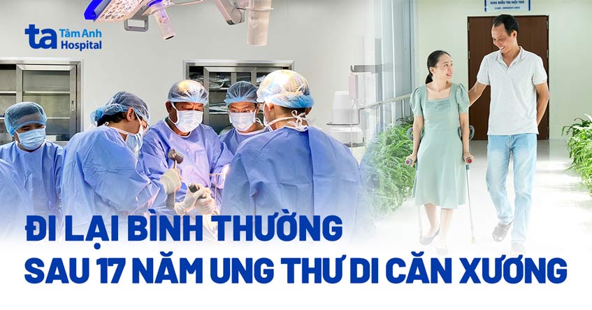 Đi lại bình thường sau 17 năm ung thư di căn xương