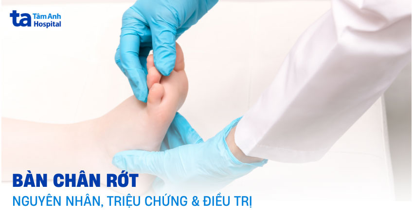 dị tật bàn chân rớt