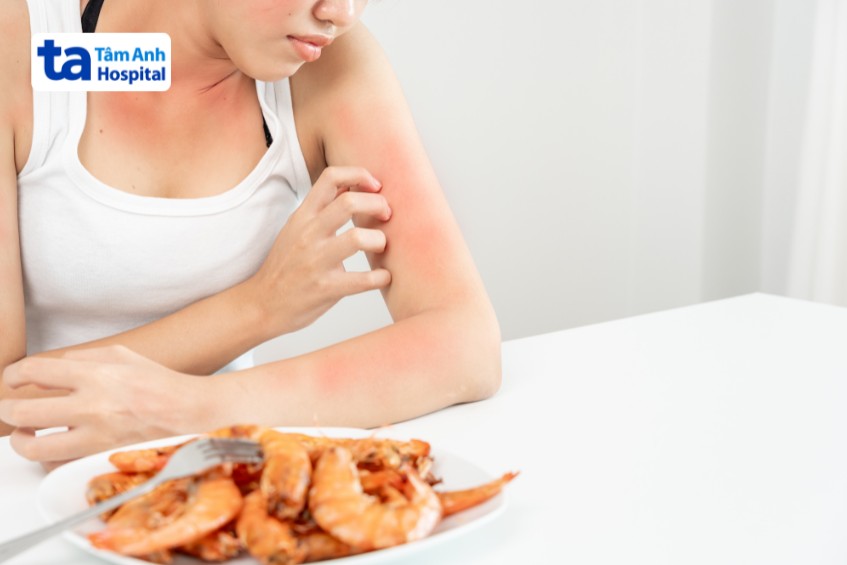 dị ứng tăng bạch cầu ái toan