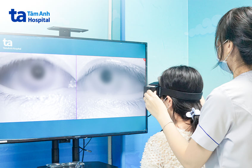 đo chức năng tiền đình