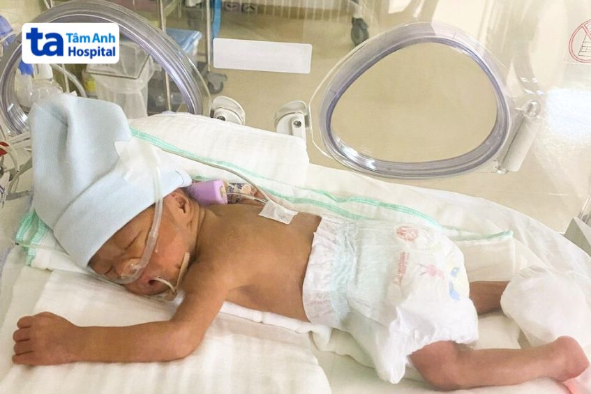 Hình ảnh về trẻ sinh non 28 tuần được chăm sóc tích cực