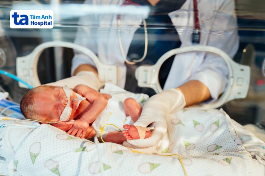 Hình ảnh về trẻ sinh non 29 tuần được bác sĩ chăm sóc