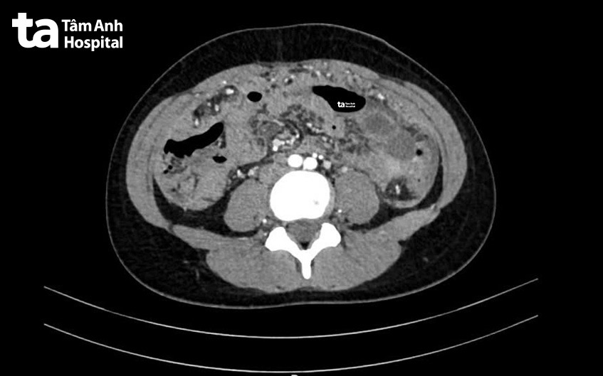 hình chụp cắt lớp vi tính