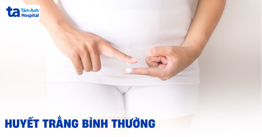 Huyết trắng bình thường là như thế nào? Hình ảnh, màu sắc, mùi vị