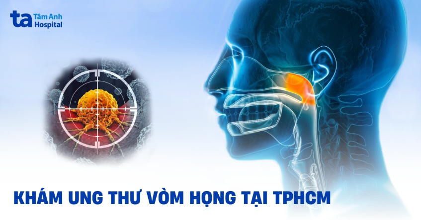 Địa chỉ khám ung thư vòm họng tại TPHCM ở đâu tốt? Tiêu chí lựa chọn