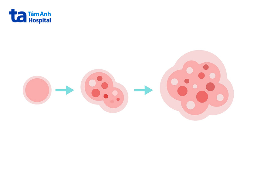 khối u ác tính vùng đầu cổ