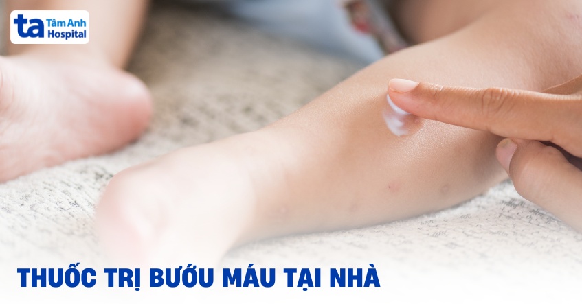 5 loại thuốc trị bướu máu tại nhà cho trẻ an toàn, hiệu quả cao