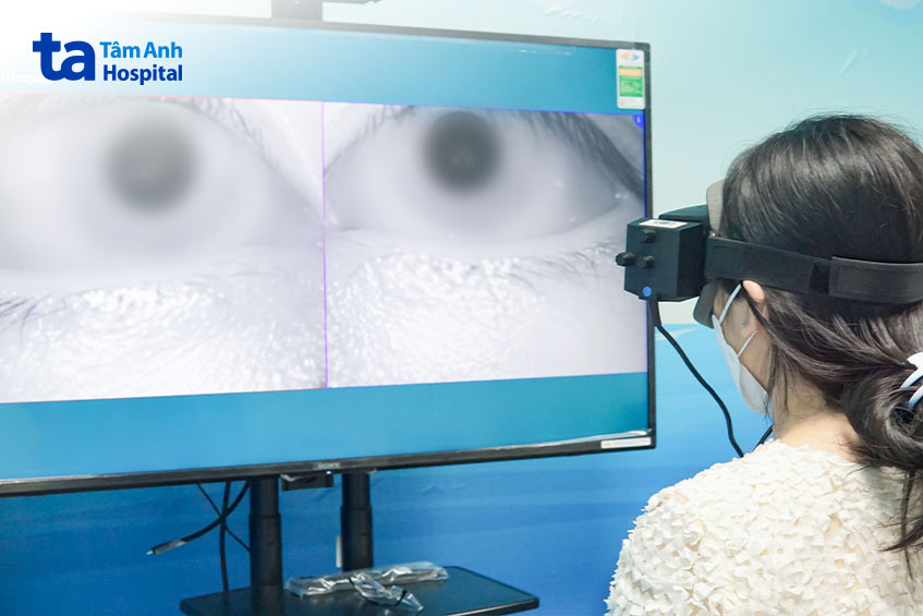 máy đo chức năng tiền đình công nghệ