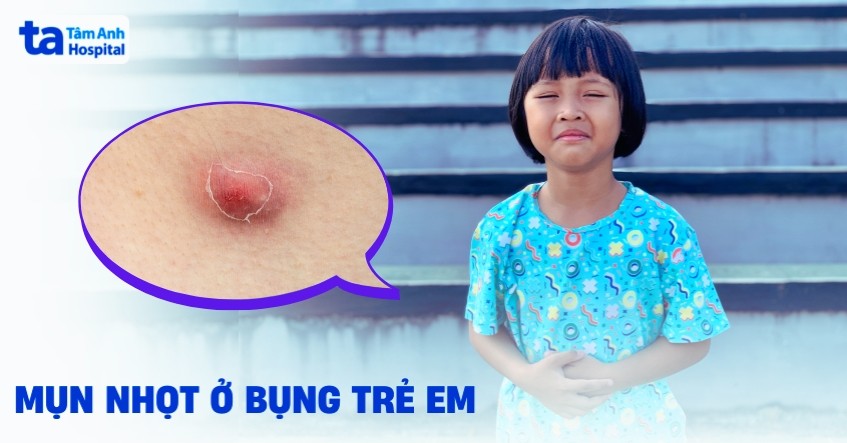 Mụn nhọt ở bụng trẻ em: Nguyên nhân, dấu hiệu và cách điều trị