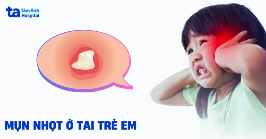 Mụn nhọt ở tai trẻ em: Nguyên nhân, dấu hiệu và cách chữa trị