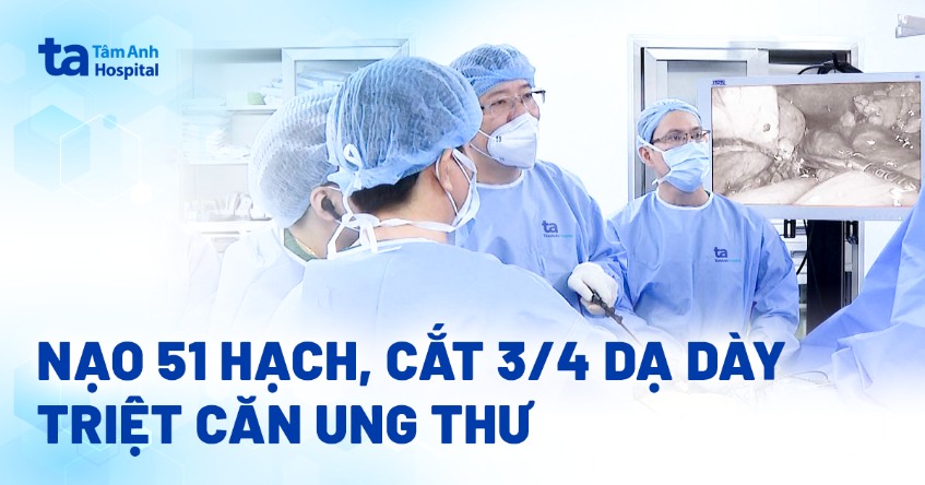 Nạo 51 hạch, cắt bán phần dạ dày triệt căn ung thư