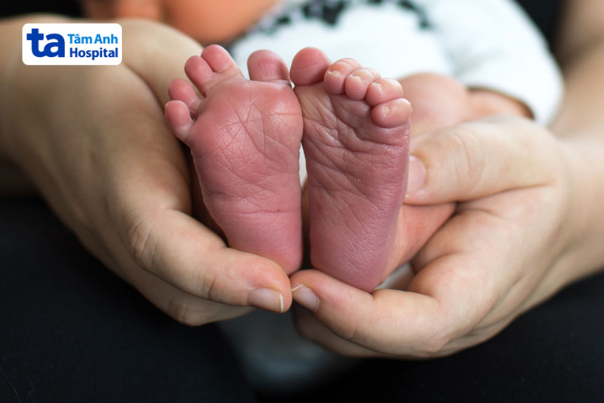 ngón chân bị dính có nhiều hình thái khác nhau