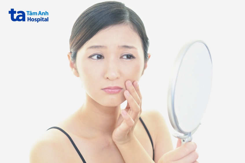 nguyên nhân xuất hiện rãnh cười