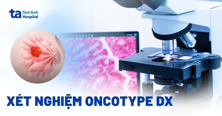 Xét nghiệm Oncotype DX: Điểm dự đoán ung thư vú di căn và tái phát