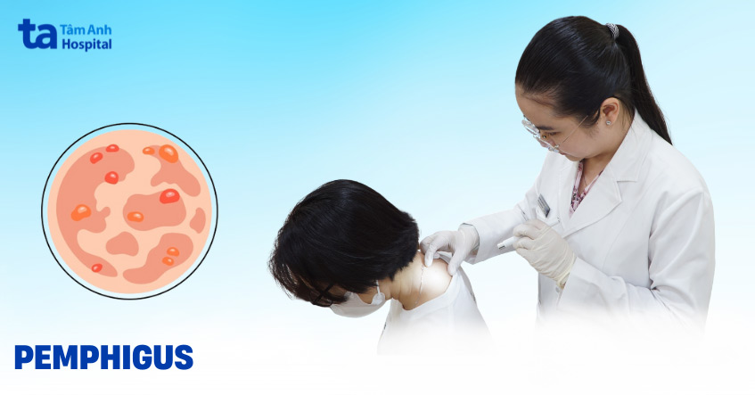 pemphigus là gì