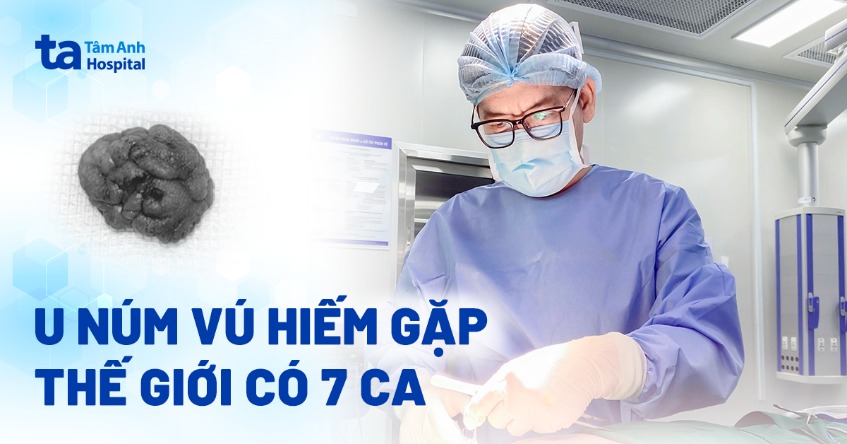Phát hiện u núm vú hiếm gặp, thế giới ghi nhận 7 ca