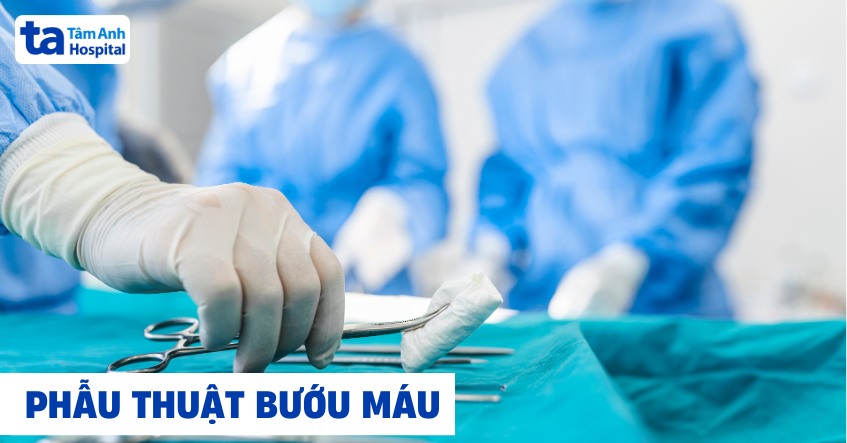 Phẫu thuật bướu máu có nên không? Khi nào nên mổ?