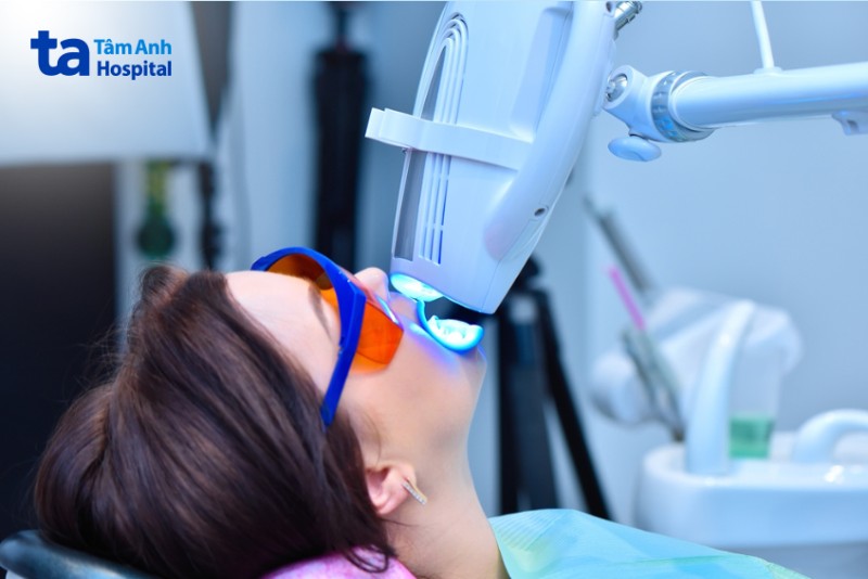 phương pháp tẩy trắng răng bằng đèn plasma