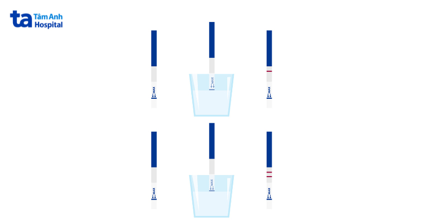 Que thử thai cần đặt thẳng, mực nước tiểu không vượt quá vạch giới hạn