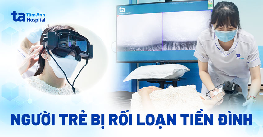 rối loạn tiền đình ở người trẻ