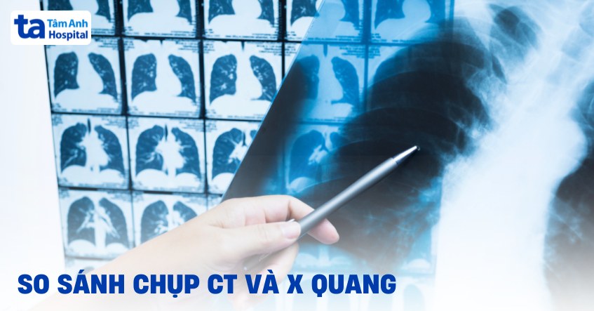 so sánh chụp CT và X quang