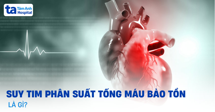 Suy tim phân suất tống máu bảo tồn (HFpEF): Chẩn đoán và điều trị