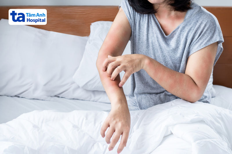 Tác dụng phụ có thể gặp khi dùng Enterogermina là phát ban, mề đay