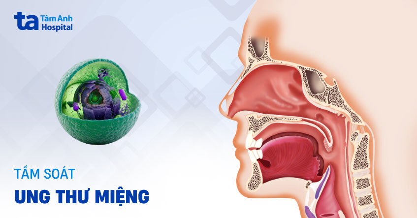 Khám và tầm soát ung thư khoang miệng ở đâu? Bao gồm những gì?