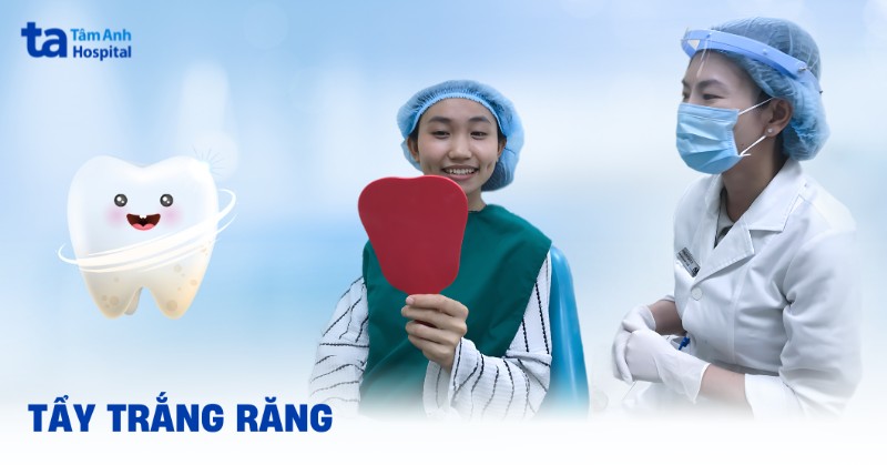 Tẩy trắng răng là gì? 5 phương pháp phổ biến hiện nay