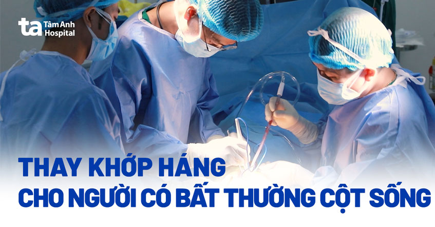 thay khớp háng cho người bất thường cột sống