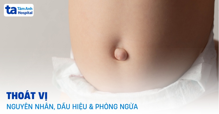 Thoát vị là gì? Nguyên nhân, dấu hiệu và cách phòng ngừa