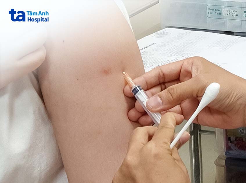 tiêm thuốc sinh học điều trị vảy nến