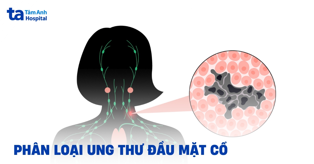11 loại ung thư đầu mặt cổ – Căn bệnh nào nguy hiểm nhất?