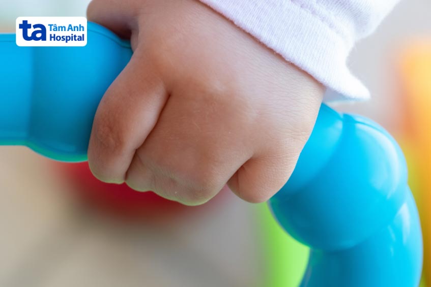 tình trạng bất thường chi ở trẻ