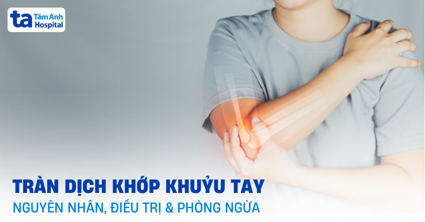 tràn dịch khớp khuỷu tay