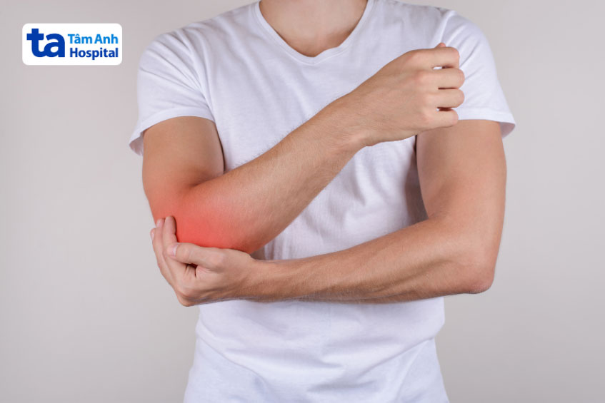 tràn dịch khủy tay do viêm bao hoạt dịch gây ra