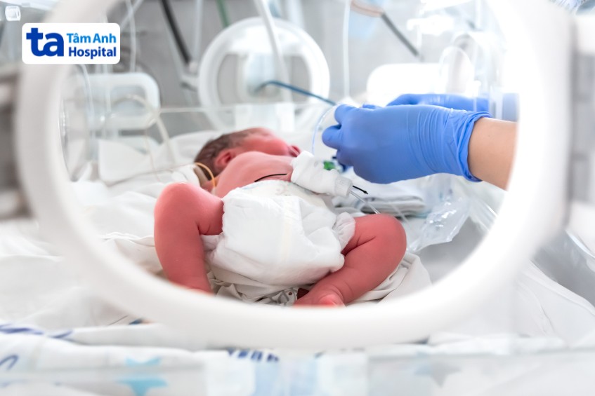 Trẻ sinh non 29 tuần sẽ được chăm sóc tích cực