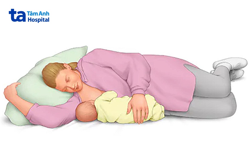 Tư thế nằm nghiêng 1 bên