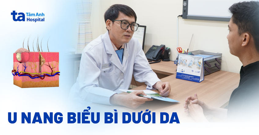 u nang biểu bì dưới da