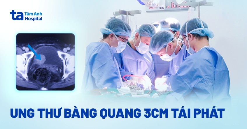 Ung thư bàng quang tái phát sớm
