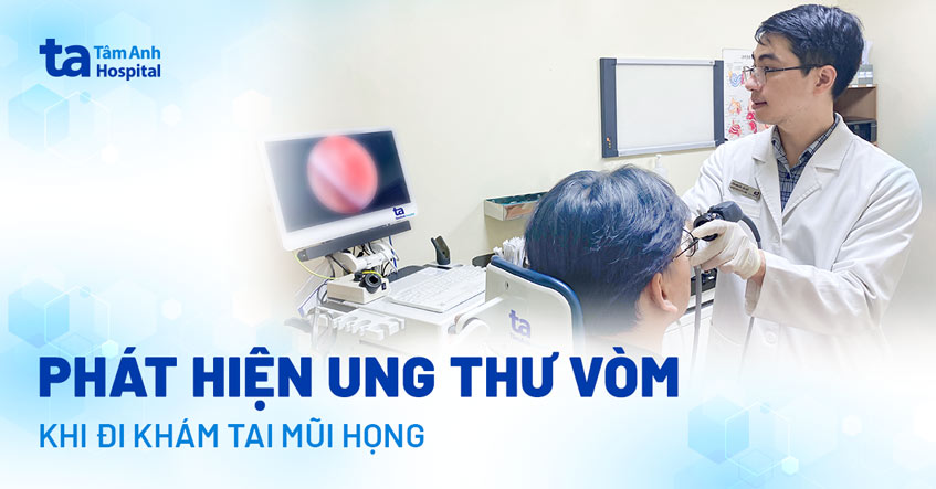 ung thư vòm nhưng lại có triệu chứng như viêm xoang