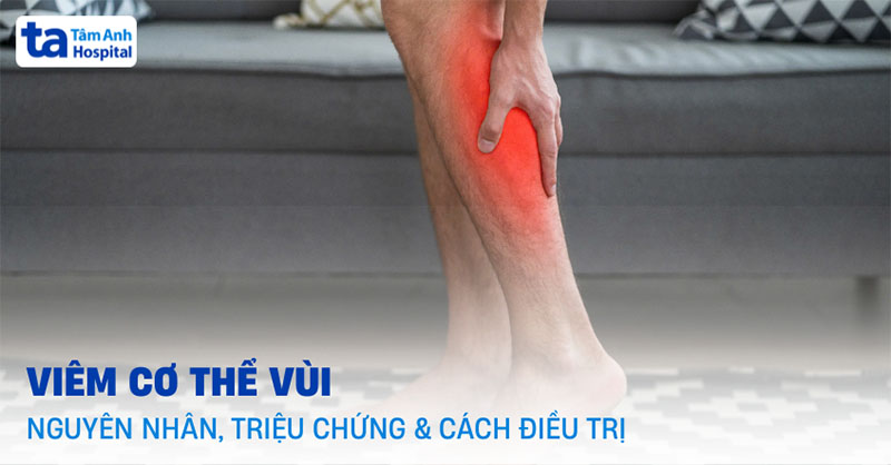 Viêm cơ thể vùi là gì
