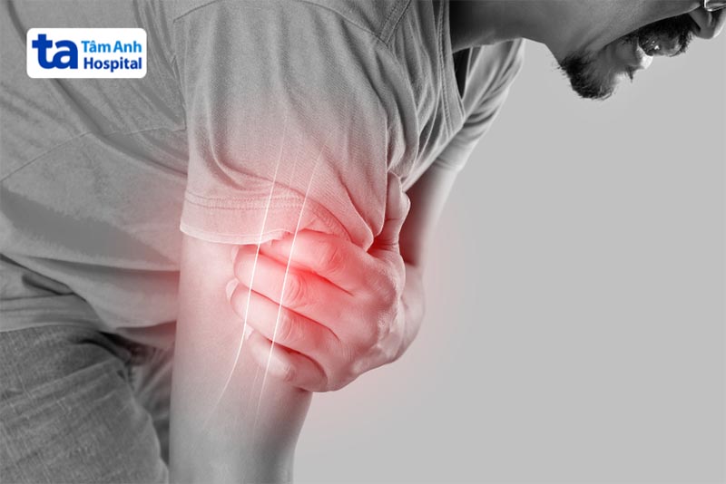 Viêm các cơ tự miễn là gì?