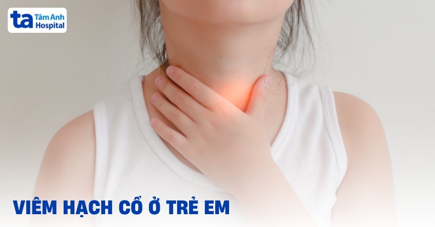 Viêm hạch cổ ở trẻ em: Nguyên nhân, dấu hiệu và cách điều trị