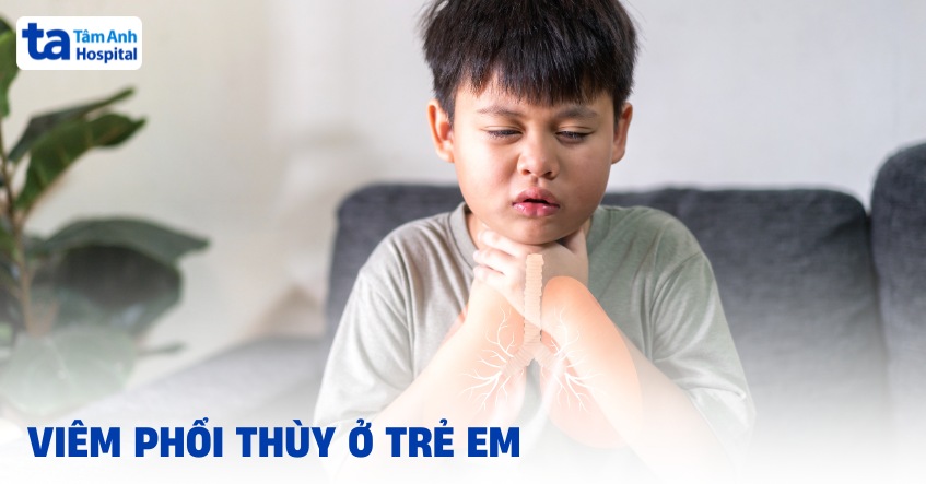 Viêm phổi thùy ở trẻ em: Nguyên nhân, triệu chứng, cách điều trị