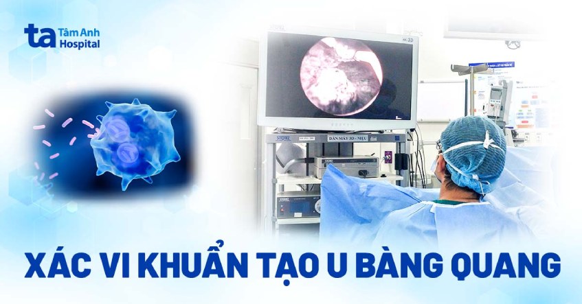 Xác vi khuẩn tạo thành khối u trong bàng quang